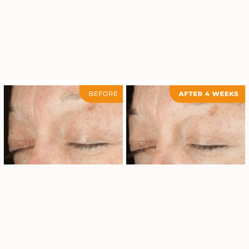 Contorno-de-Ojos-Universal-C-Eye-Perfector